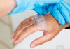 Complex Wound Care